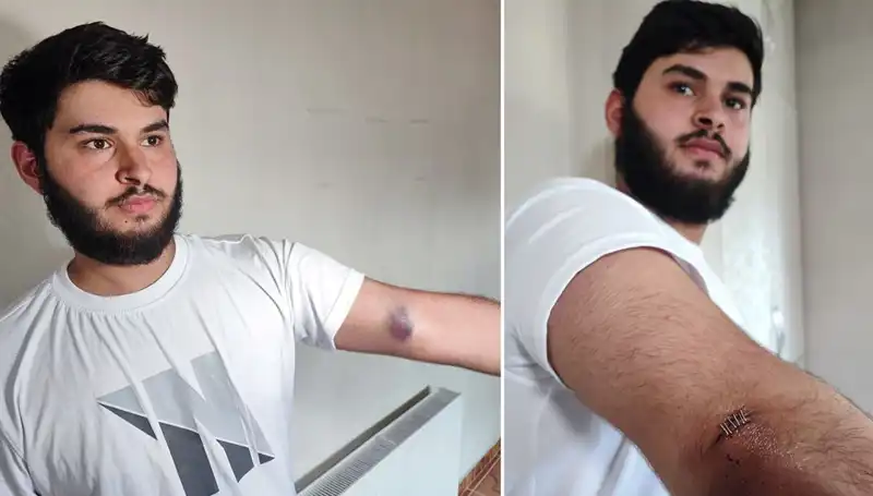 Bahçeye Kaçan Top Rahatsızlığı: Mahallede Conolar Kamyonetle Geldi!
